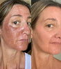 Dr. Melaxin Glow RiceGlass Skin Premium Kit (6 pcs)™