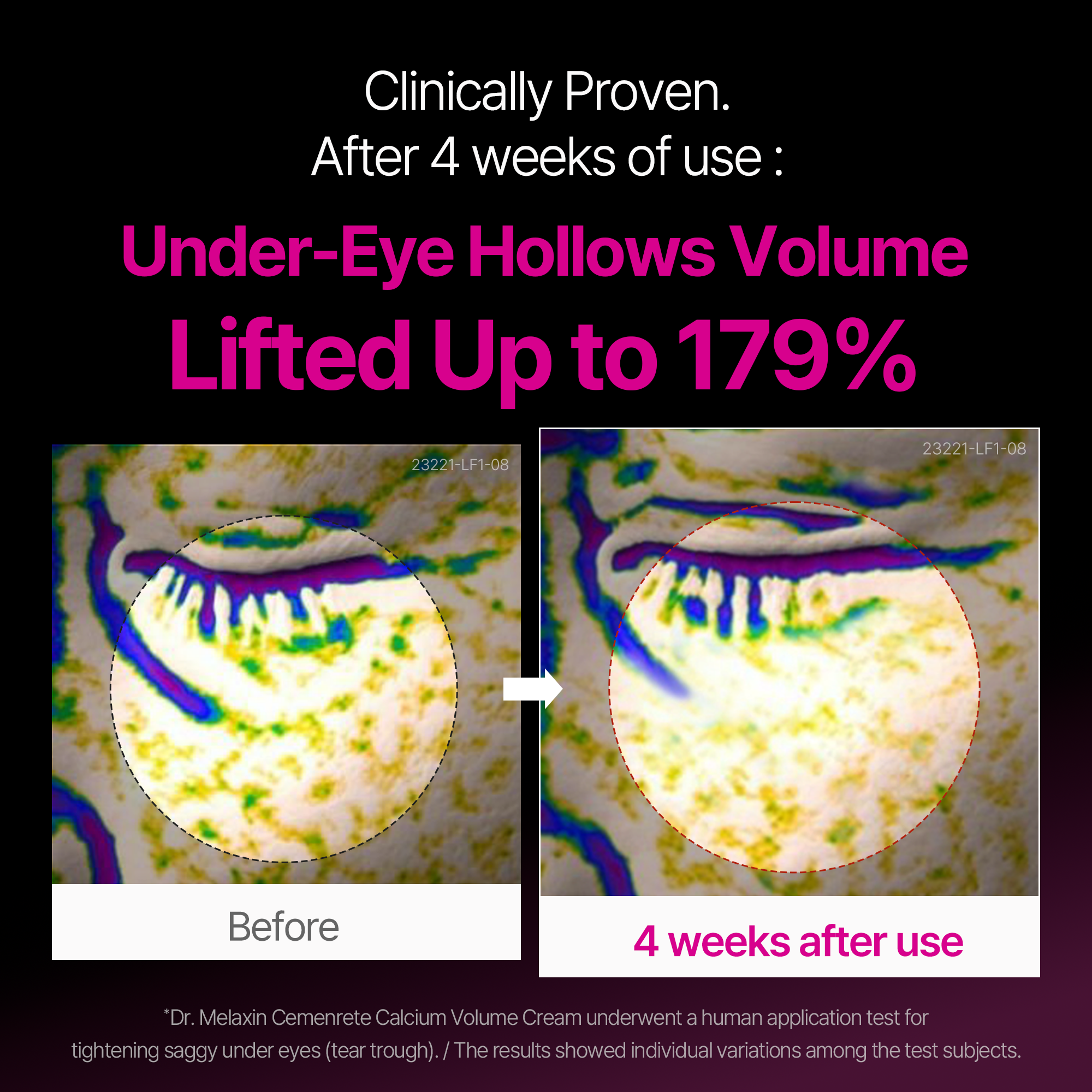 Cemenrete Calcium Eyecare Routine Kit
