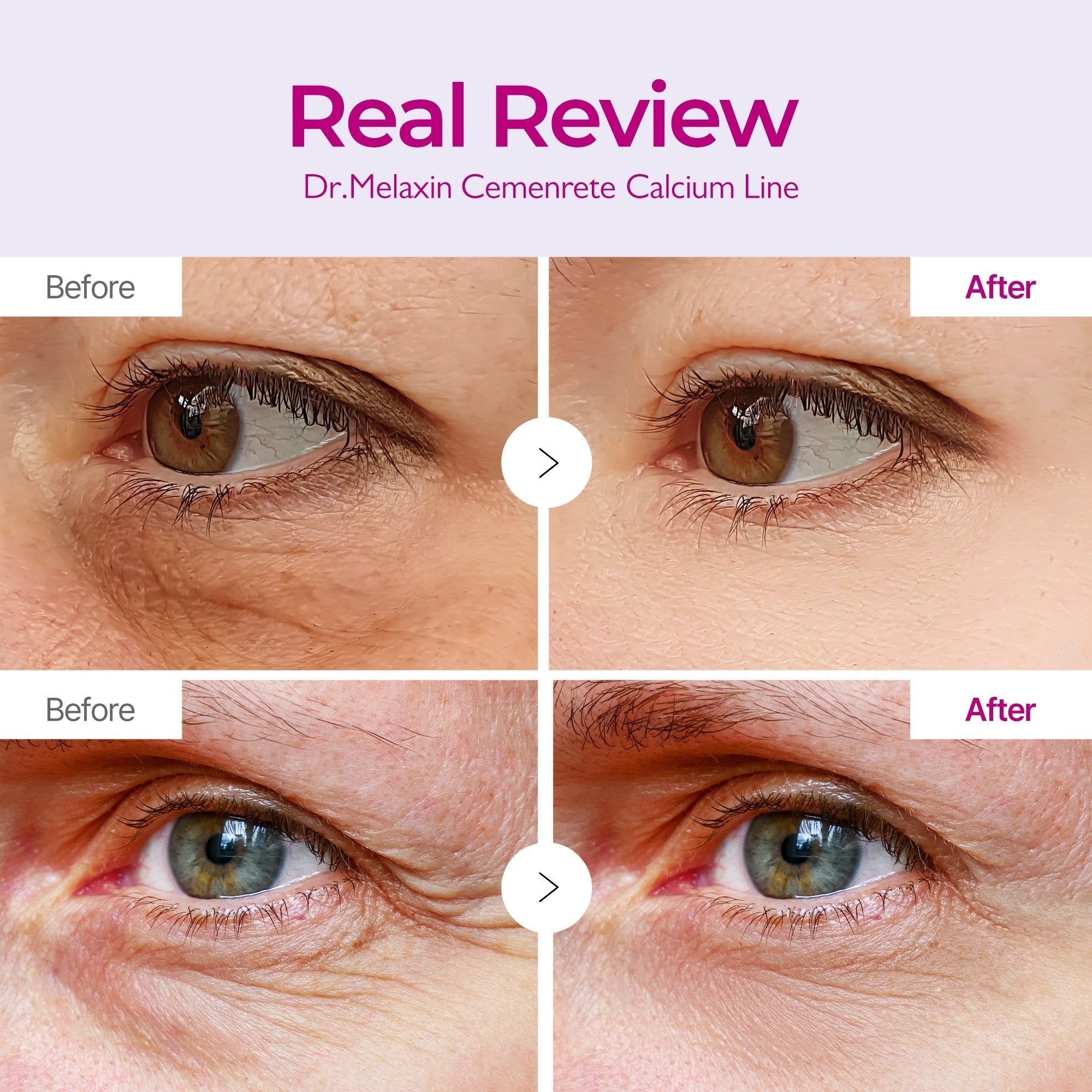 Cemenrete Calcium Volume Eye patch 60ea