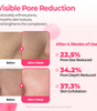 Cemenrete Cyano Pink Spicule Set