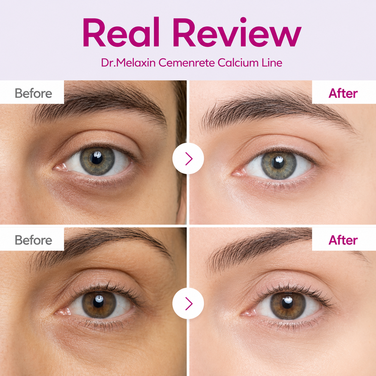 Cemenrete Calcium Eyecare Routine Kit