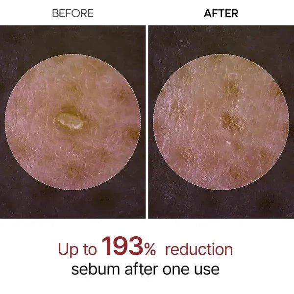 Dr. Melaxin Rice Peel Ampoule Duo