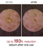 Peel Shot Glow White Rice Ampoule
