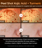 Peel Shot kojic Acid Turmeric Serum