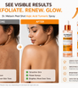 Radiant Glow Duo Peeling Kit™