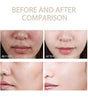 Dr. Melaxin Glow RiceGlass Skin Premium Kit (6 pcs)™
