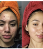 Dr. Melaxin Glow RiceGlass Skin Premium Kit (6 pcs)™