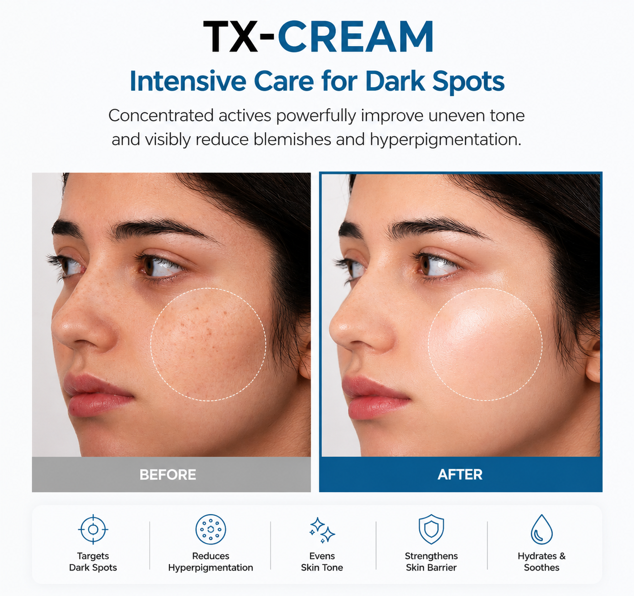 TX Cream